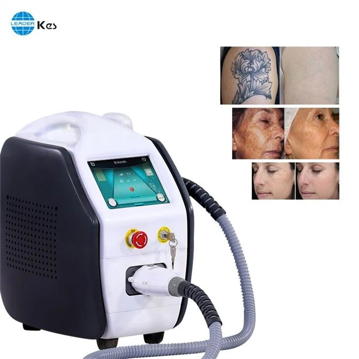 Nd Yag Tattoo Removal Laser Apparatus