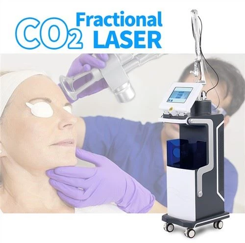 Macchina laser frazionata professionale a CO2 per il serraggio vaginale