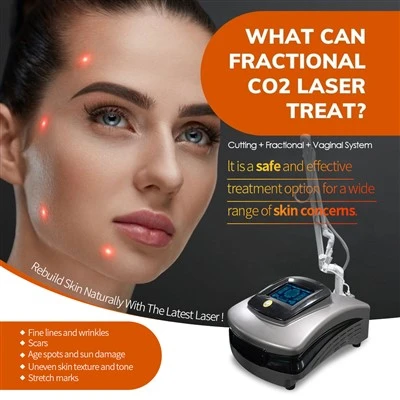 Resurfacing per la pelle della macchina laser di CO2 più recente