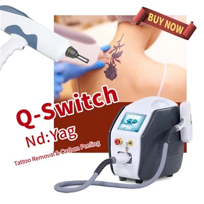 Apparecchio laser per la rimozione professionale del tatuaggio